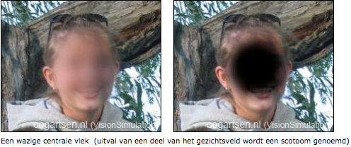 Copyright dr. V.P.T. Hoppenreijs, oogarts Deventer ziekenhuis(C) 2004-2015